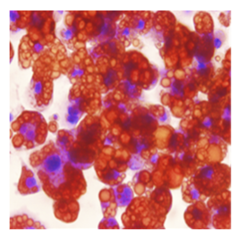 RED OIL O Staining Protocol 2