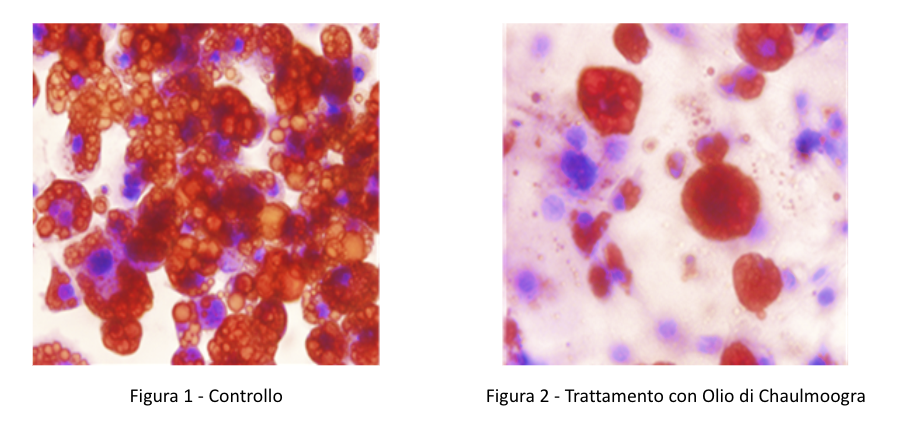 Inibizione della perossidazione lipidica indotta dai raggi UV